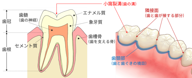 う蝕好発部位