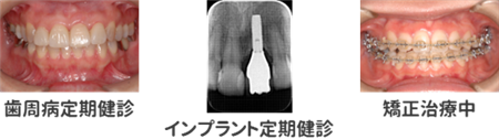 光殺菌で予防